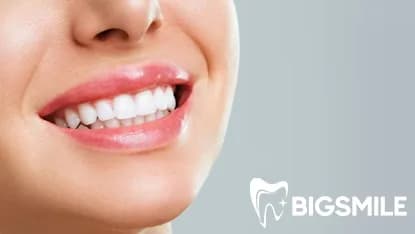 Dental Veneers