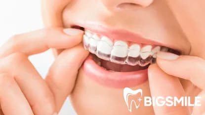 Invisalign